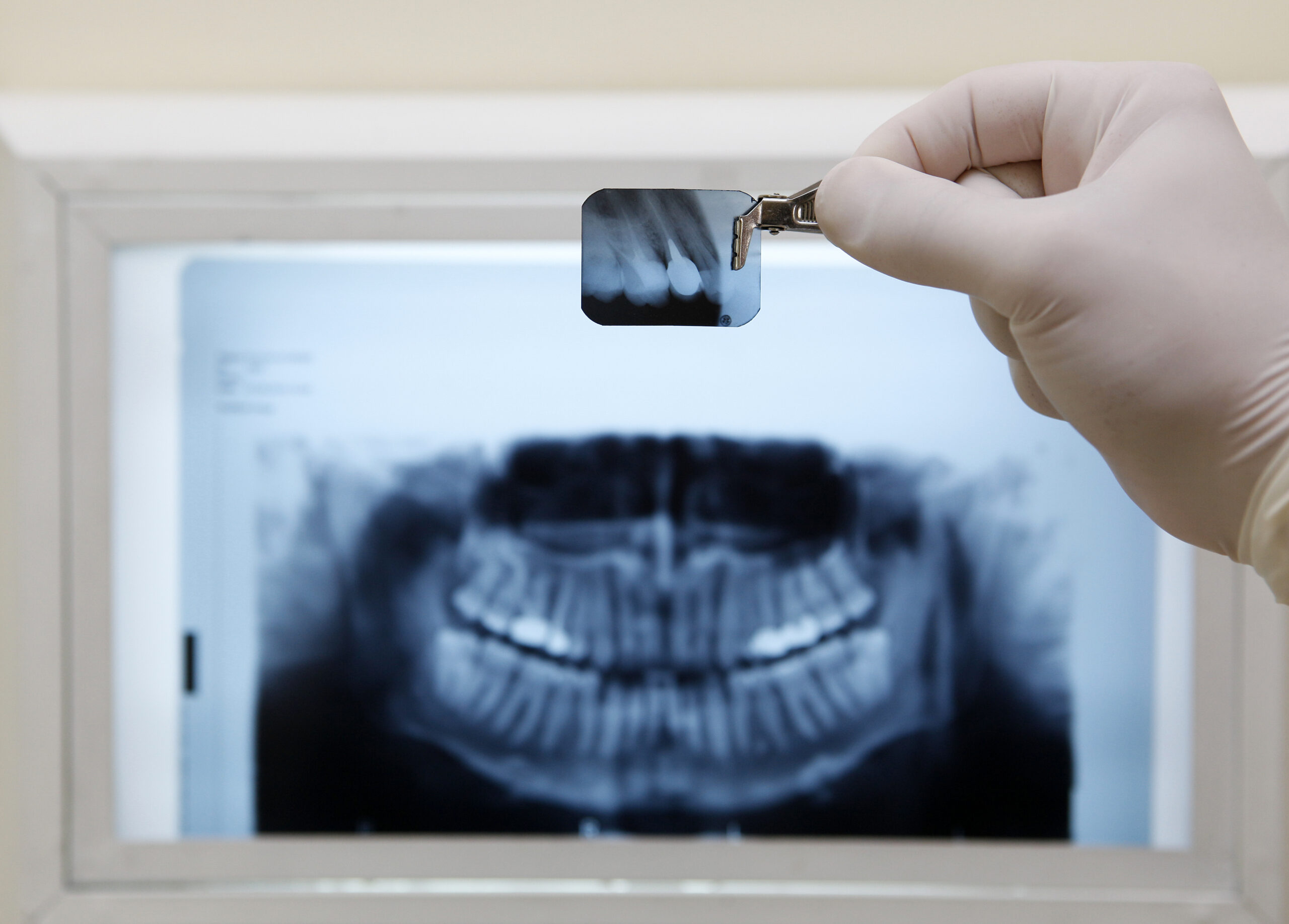 Dental Exams